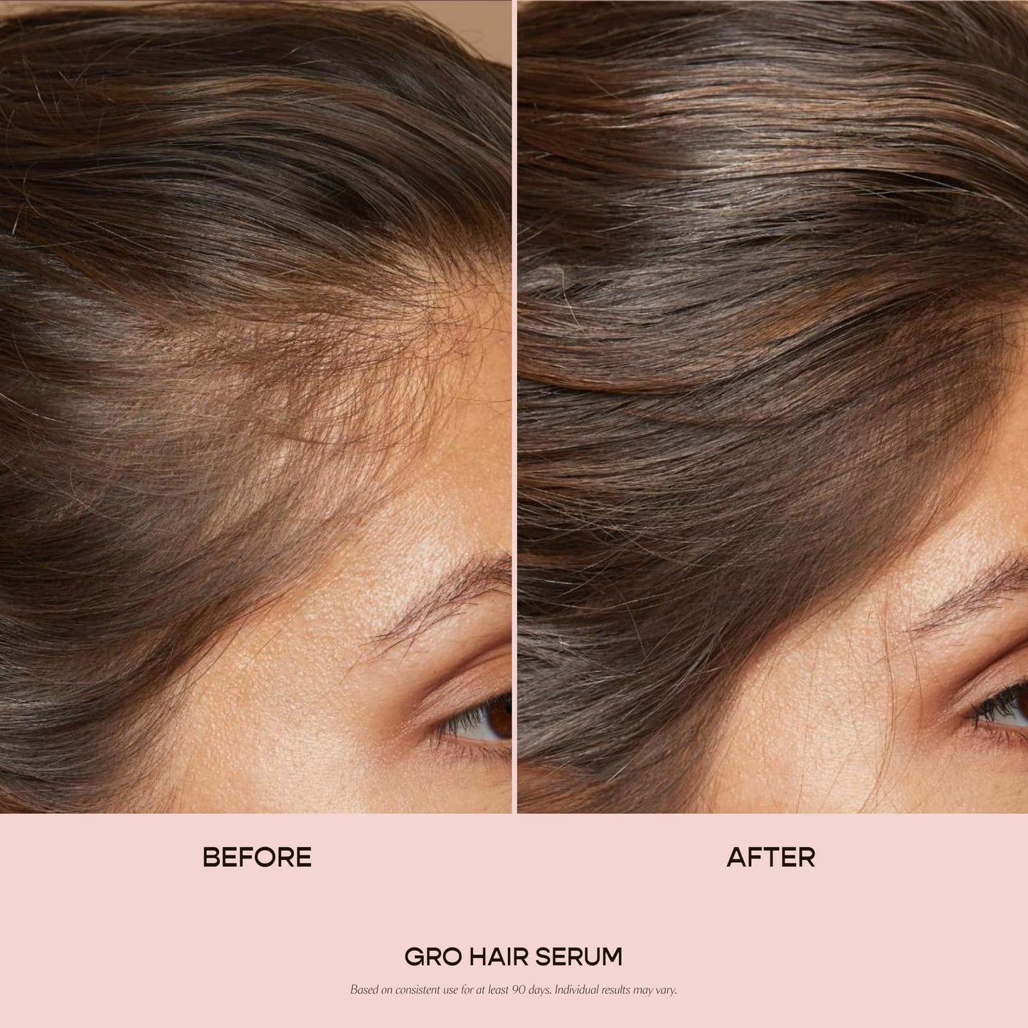 VEGAMOUR GRO Hair Serum for Hair Thinning, Thicker Fuller Looking Hair, Non Oily Tonic, 3 pack, 90 day supply VEGAMOURBuy Supplements Australia
