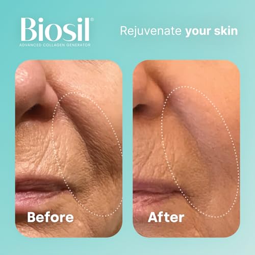 Biosil Collagen Generator - 120 Capsules - with Patented ch-OSA Complex - Generates & Protects Your Own Collagen BioSilBuy Supplements Australia