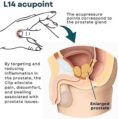 XEYOW Prostate Care Point Clip for Men, Acupressure Hand Pressure Point Clip, Relieve Prostate XEYOW