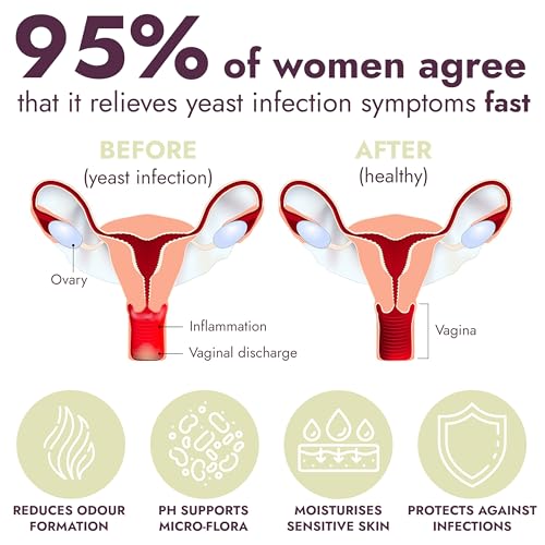 Yeast Infection Treatment for Women | 7 Pre-Filled Applicators w/ Borax | Antifungal Ointment Terramed Just Think Comfort