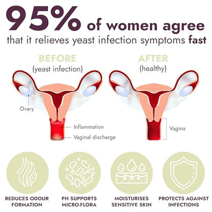 Yeast Infection Treatment for Women | 7 Pre-Filled Applicators w/ Borax | Antifungal Ointment Terramed Just Think Comfort