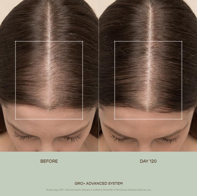 VEGAMOUR GRO+ Advanced Hair Serum for Improving Hair Density, Tonic Reduces Shedding and Promotes a Healthy Scalp, 1 pack VEGAMOURBuy Supplements Australia
