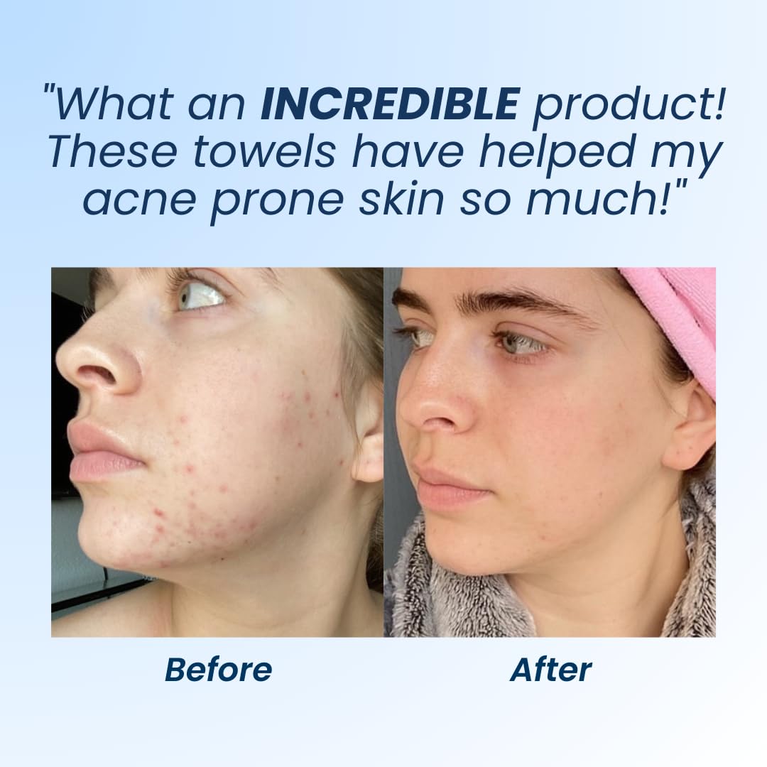 Clean Skin Club Clean Towels XL, Biodegradable Dermatologist Approved CLEAN SKIN CLUBBuy Supplements Australia