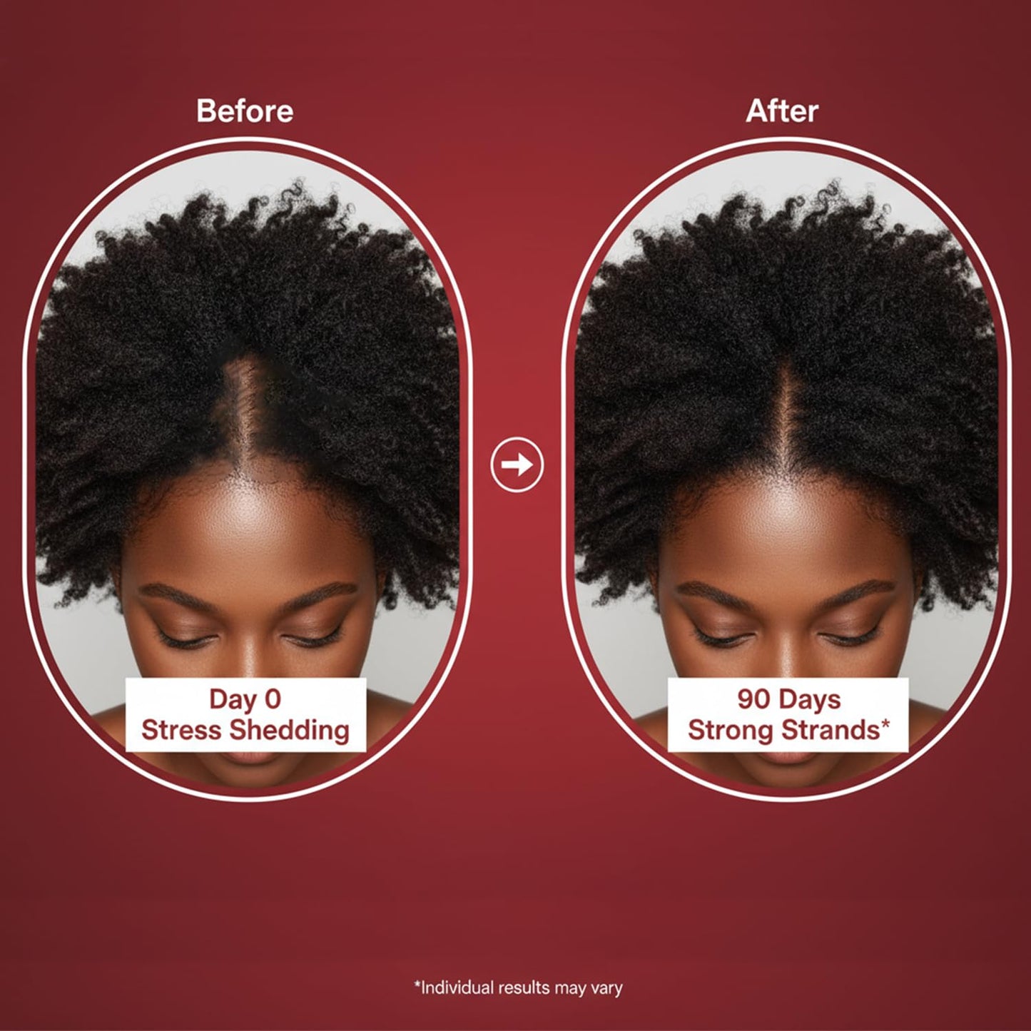 Lumin Hair Growth Gummies for Black Women, 60 Vegan Gummies, Daily Hair Nourishment with Biotin, Collagen & Botanical Extracts, Supports Healthy Hair Growth & Strength Lumin HairBuy Supplements Australia