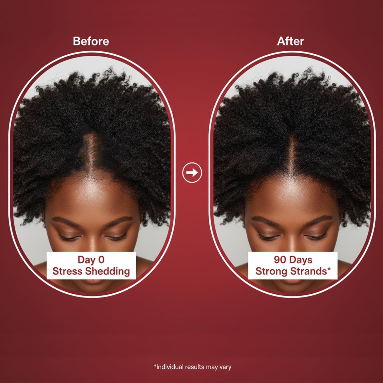 Lumin Hair Growth Gummies for Black Women, 60 Vegan Gummies, Daily Hair Nourishment with Biotin, Collagen & Botanical Extracts, Supports Healthy Hair Growth & Strength Lumin HairBuy Supplements Australia