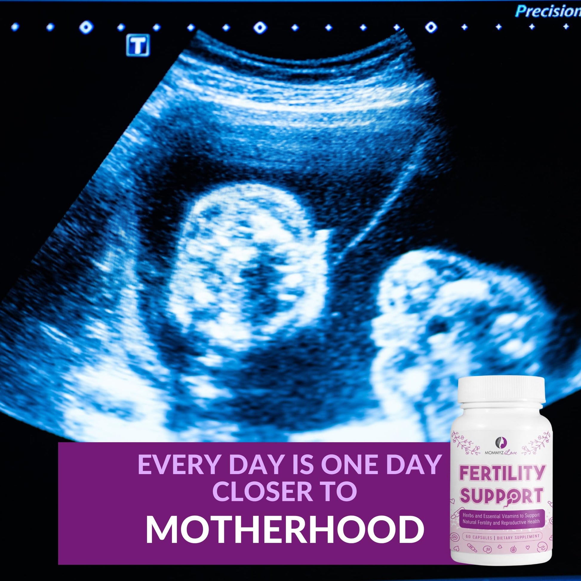 Mommyz Love Myo-Inositol Conception Fertility Prenatal Vitamins for Healthy Ovarian Function Mommyz Love