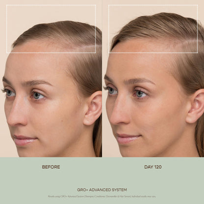 VEGAMOUR GRO+ Advanced Essentials Kit | Removes Buildup, Improves Hair Density, Reduces Shedding, Hydrates and Exfoliates the Scalp | For Severe Signs of Thinning | Color Safe, Vegan, Cruelty-Free VEGAMOURBuy Supplements Australia