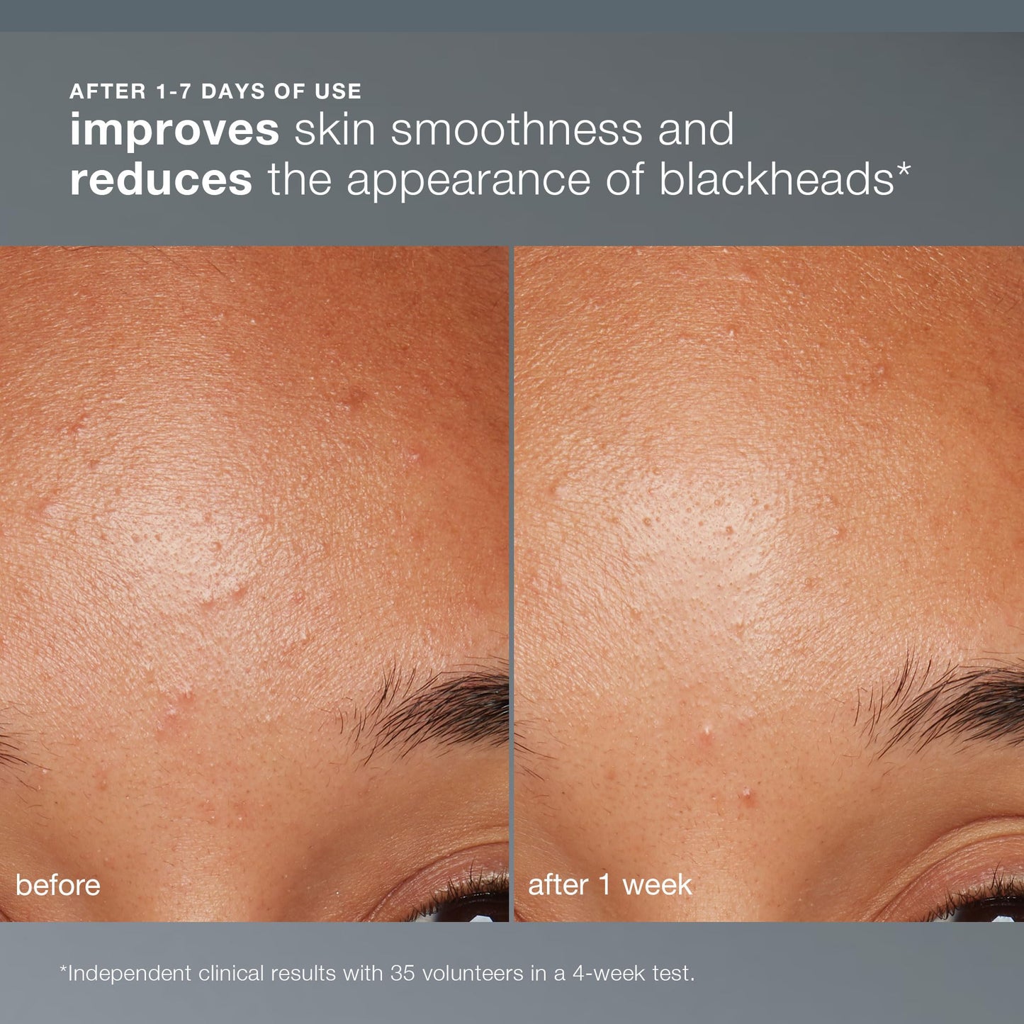 Dermalogica Daily Microfoliant, Face Exfoliator Scrub Powder with Salicylic Acid and Papaya