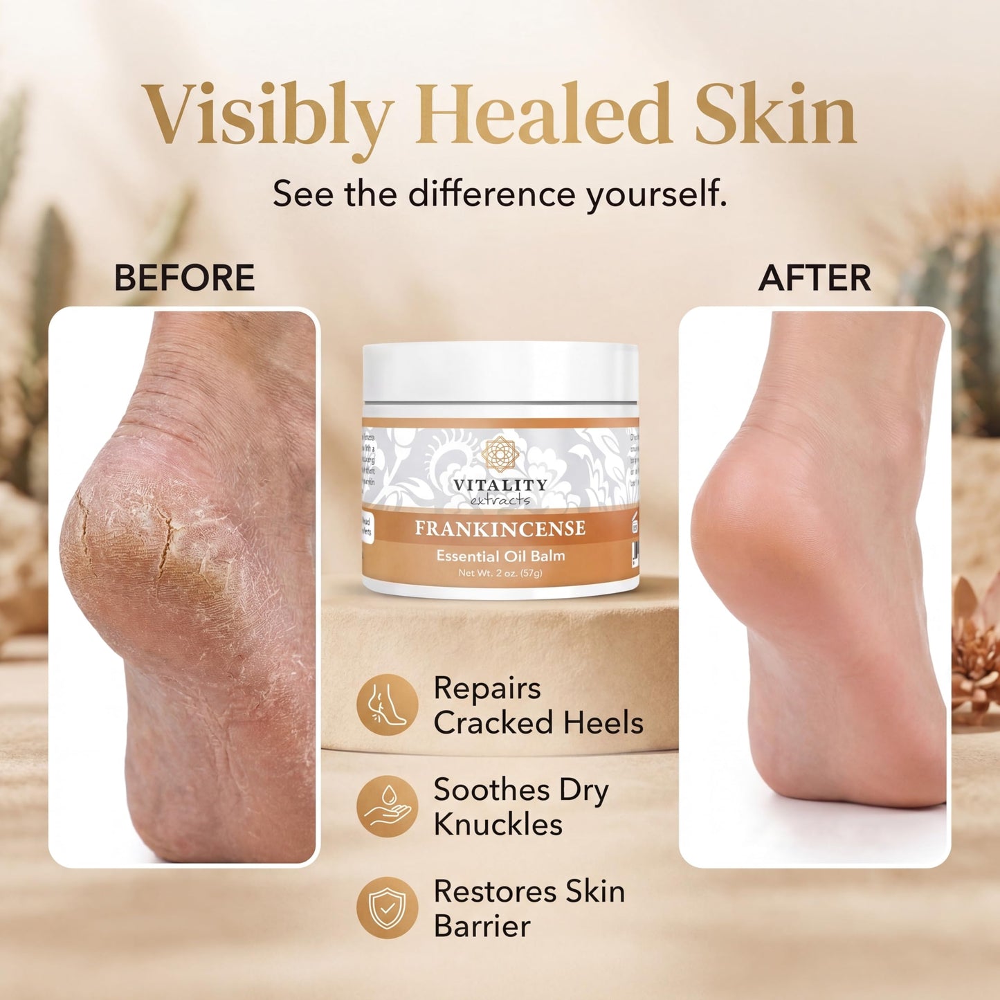 Vitality Extracts Frankincense Balm - 2oz, Boswellia Serrata, Beeswax, Olive Oil, Moisturizer for Dry, Cracked Skin, All Skin Types