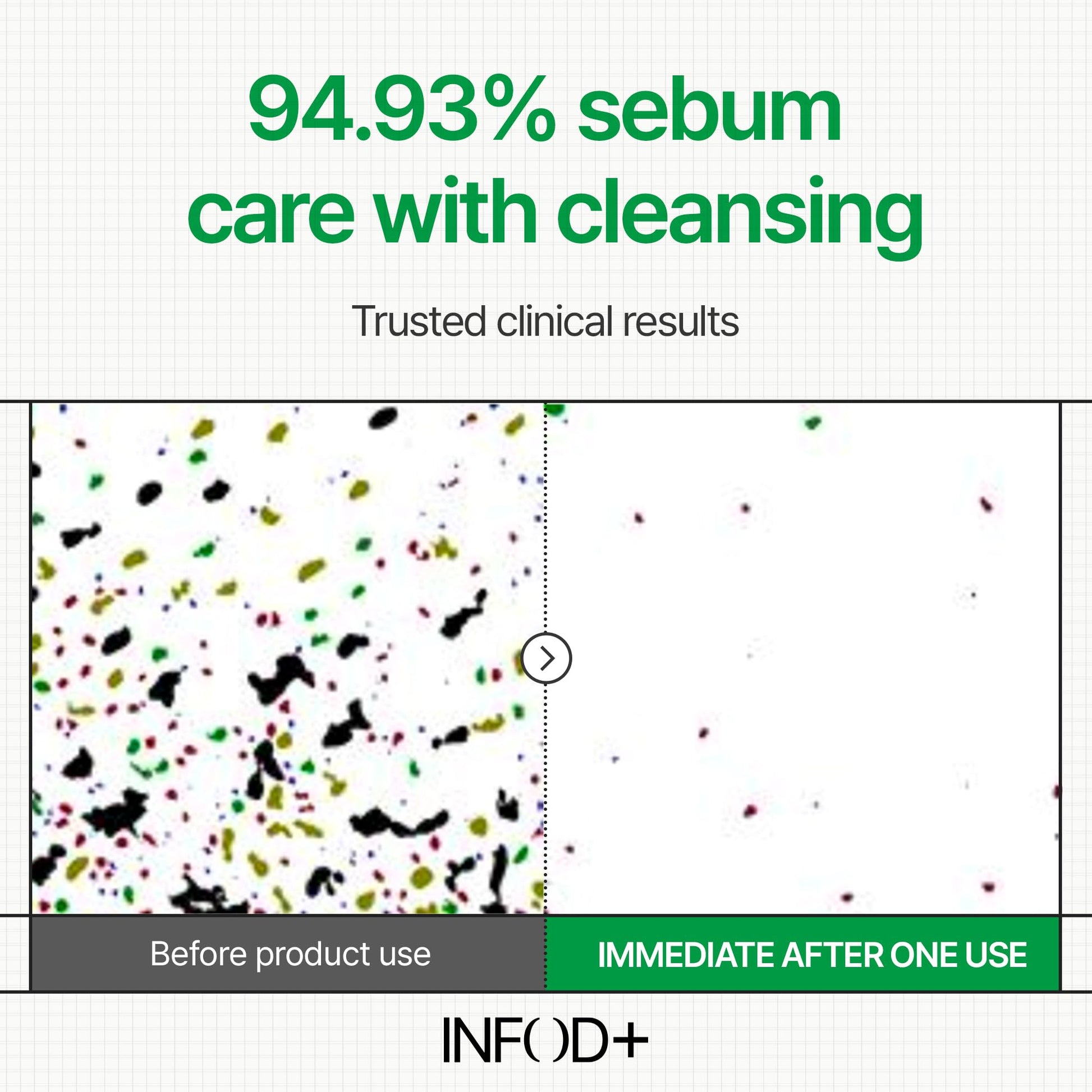 INFODPLUS Gel Cleanser, Gentle Low pH Deep Cleansing, Oil Control, Pore Blackhead Removal Face Wash, Ceramide Panthenol, Hydrating Barrier Balance Korean Skincare for Sensitive Skin, 3.38 fl.oz 100ml INFOD+ buy supplements Au